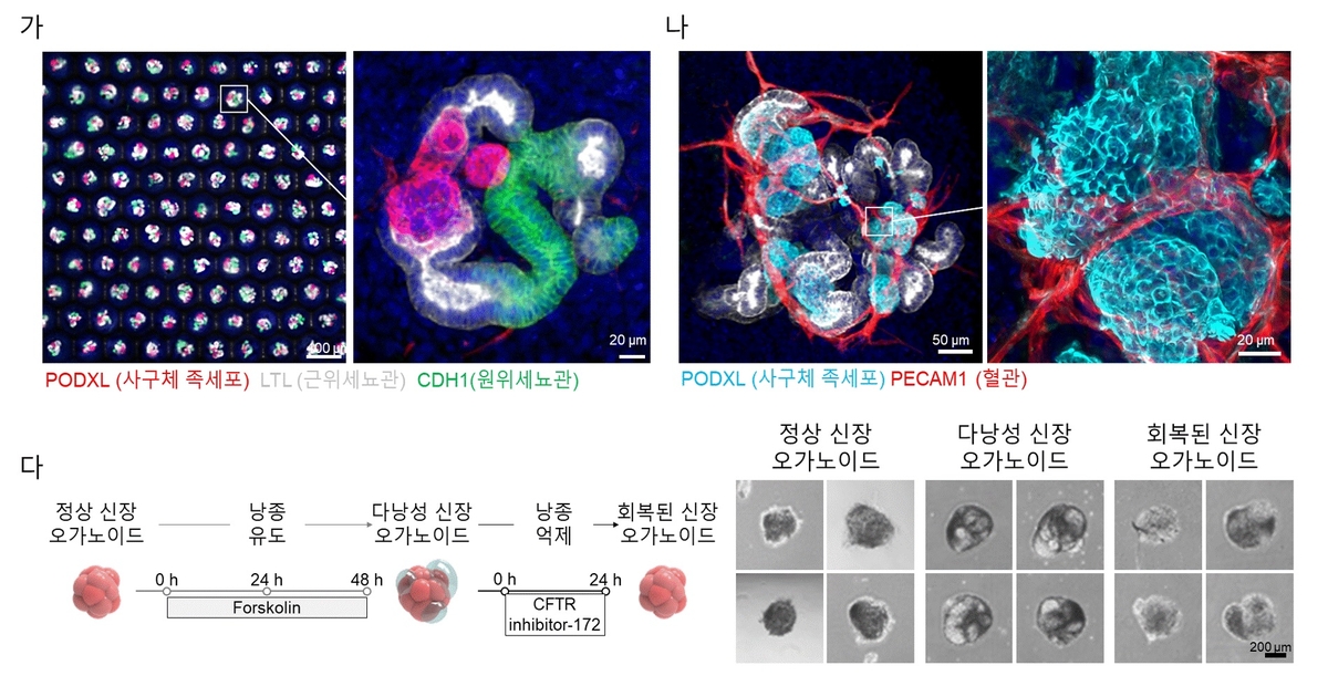 연구팀이 생산한 신장 오가노이드 ⓒ김동성 교수 제공